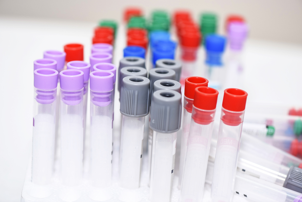 empty blood tubes